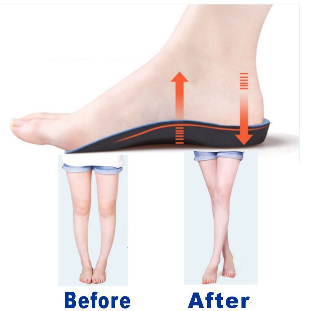 Custom Insole High Arch Support Cushion Orthotic Shoe Insole