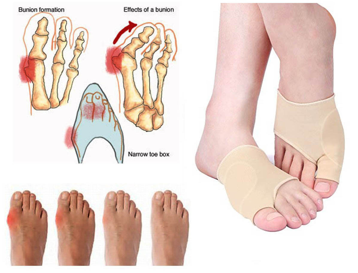 2018 New Massage Ball BigToe Protector Stretcher Bunion Valgus Hallux Corrector Kits Footcare