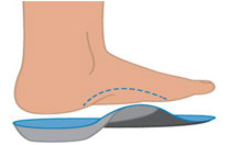 Wearing feet orthotics insoles is a treatment